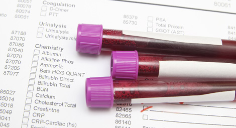 3 vials of blood on top of a blood test form